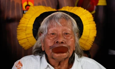 Cacique Raoni, Símbolo da Amazônia, é Transferido para SP para Continuação de Tratamento Médico Urgente