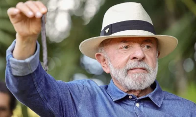 Lula viaja para SP para procedimento simples no couro cabeludo e trata tendinite no polegar; veja detalhes